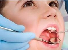 ارتباط بهداشت بد دهان و دندان با خطر ابتلا به دیابت