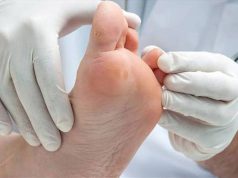 پیشگیری و درمان مشکلات پای دیابتی