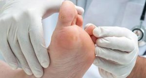 پیشگیری و درمان مشکلات پای دیابتی