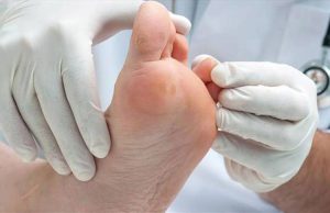 پیشگیری و درمان مشکلات پای دیابتی