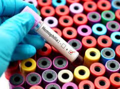 عفونت در بیماران هموفیلی