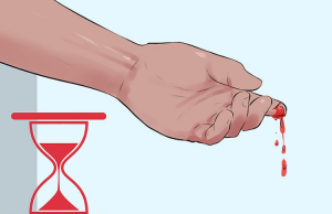 عمده مشکلات روانشناختی بیماران هموفیلی چیست؟