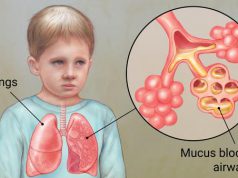 لزوم حمایت دولت از بیماران CF