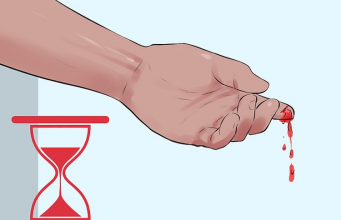 اصول کلی مراقبت در بیماران هموفیلی