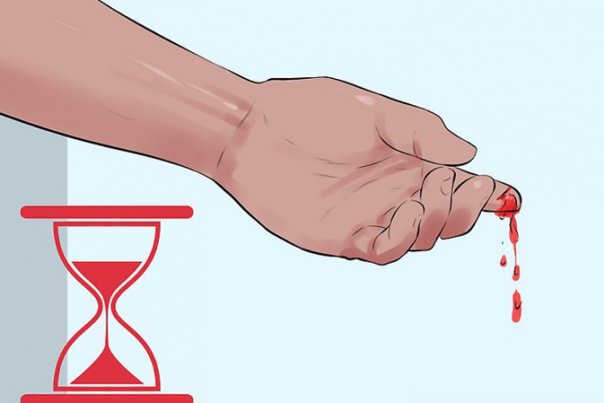 اصول کلی مراقبت در بیماران هموفیلی