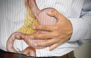 مشکلات گوارشی بیماران در حین درمان سرطان