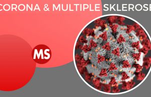 بیماری ام اس در دوره کرونا
