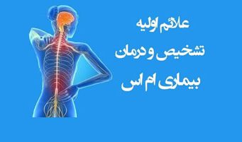 بیماری MS چیست و چه علائمی دارد؟