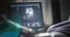 با طرح عدم غربالگری، باید شاهد افزایش کودکان مبتلا به تالاسمی در آینده باشیم