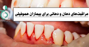 مراقبتهای دهان و دندانی برای بیماران هموفیلی