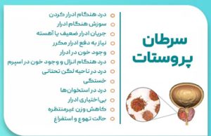 سرطان پروستات در ایران و مراقبتهای آن