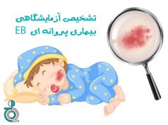 تشخیص آزمایشگاهی EB