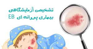 تشخیص آزمایشگاهی EB