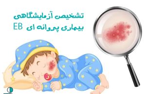 تشخیص آزمایشگاهی EB
