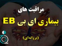 مراقبت های بیماری EB