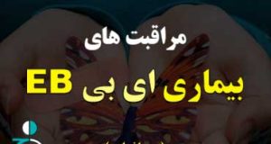 مراقبت های بیماری EB