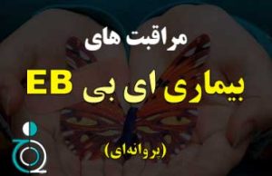 مراقبت های بیماری EB