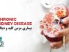 بیماری مزمن کلیه و دیالیز
