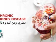 بیماری مزمن کلیه و دیالیز