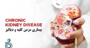 بیماری مزمن کلیه و دیالیز
