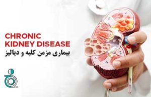 بیماری مزمن کلیه و دیالیز