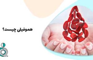 هموفیلی چیست؟
