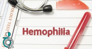 سطوح شدت بیماری هموفیلی