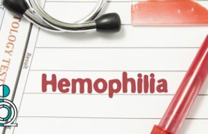 سطوح شدت بیماری هموفیلی