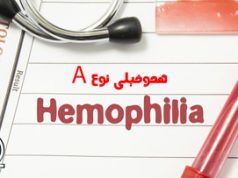 هموفیلی اکتسابی نوع A