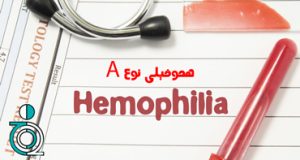 هموفیلی اکتسابی نوع A