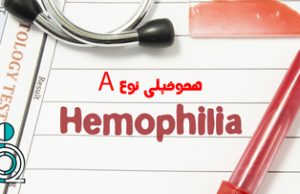 هموفیلی اکتسابی نوع A