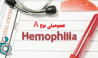 هموفیلی اکتسابی نوع A