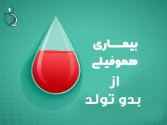 هموفیلی از بدو زندگی