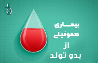 هموفیلی از بدو زندگی