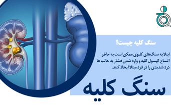 سنگ کلیه