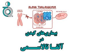 بیماریهای کبدی در آلفا تالاسمی
