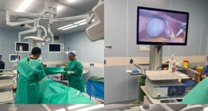 انجام نخستین عمل جراحی لاپاراسکوپی در بیمارستان آیتالله هاشمی رفسنجانی شرق