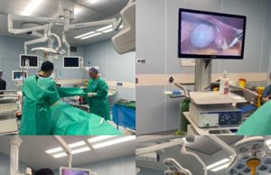 انجام نخستین عمل جراحی لاپاراسکوپی در بیمارستان آیتالله هاشمی رفسنجانی شرق