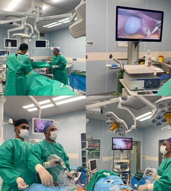 انجام نخستین عمل جراحی لاپاراسکوپی در بیمارستان آیتالله هاشمی رفسنجانی شرق